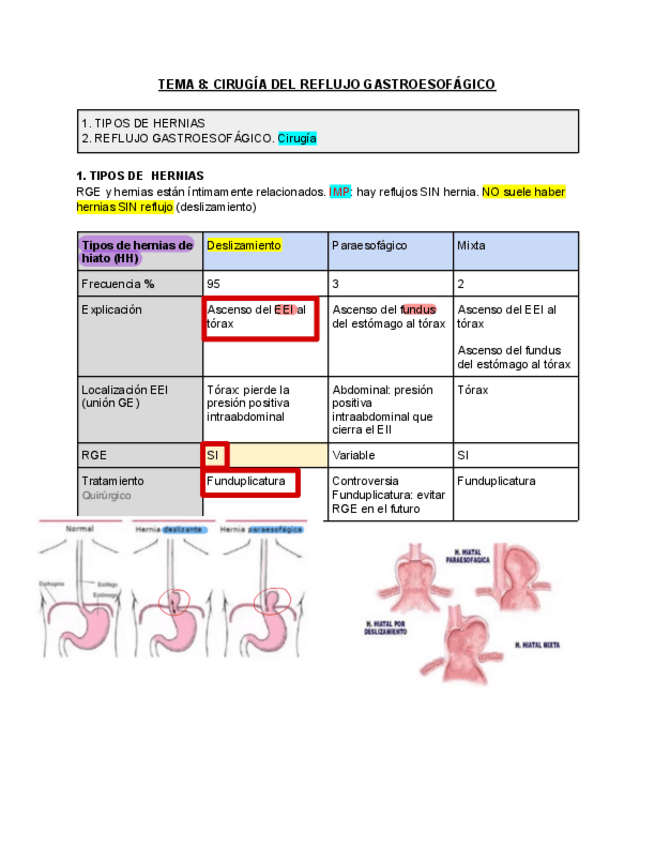 Miniatura del documento 8.-Reflujo-gastroesofagico.-Cirugia.pdf