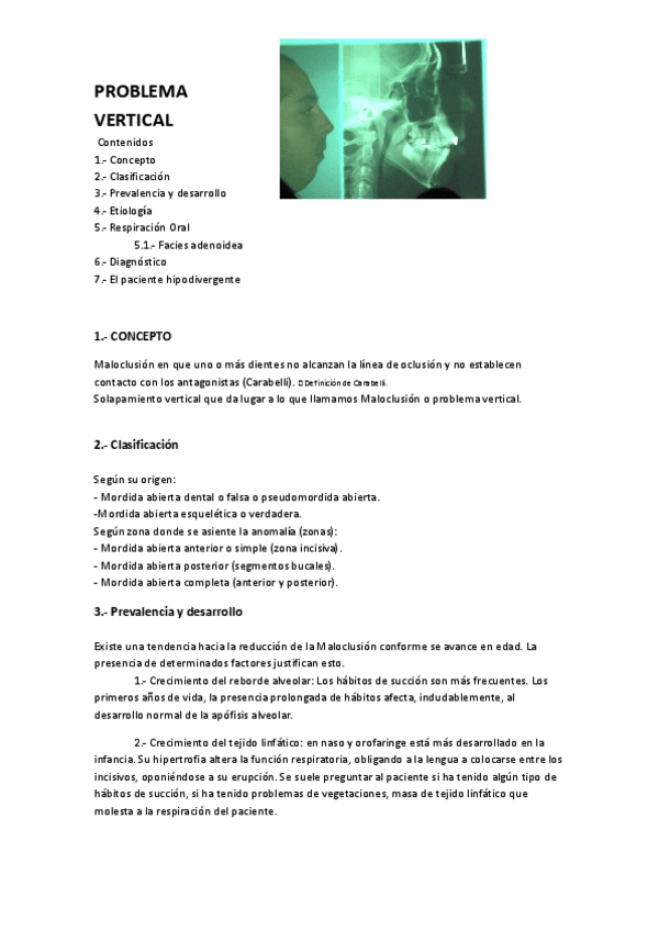 Miniatura del documento TEMA-9.-PROBLEMA-VERTICALdoc.doc.pdf