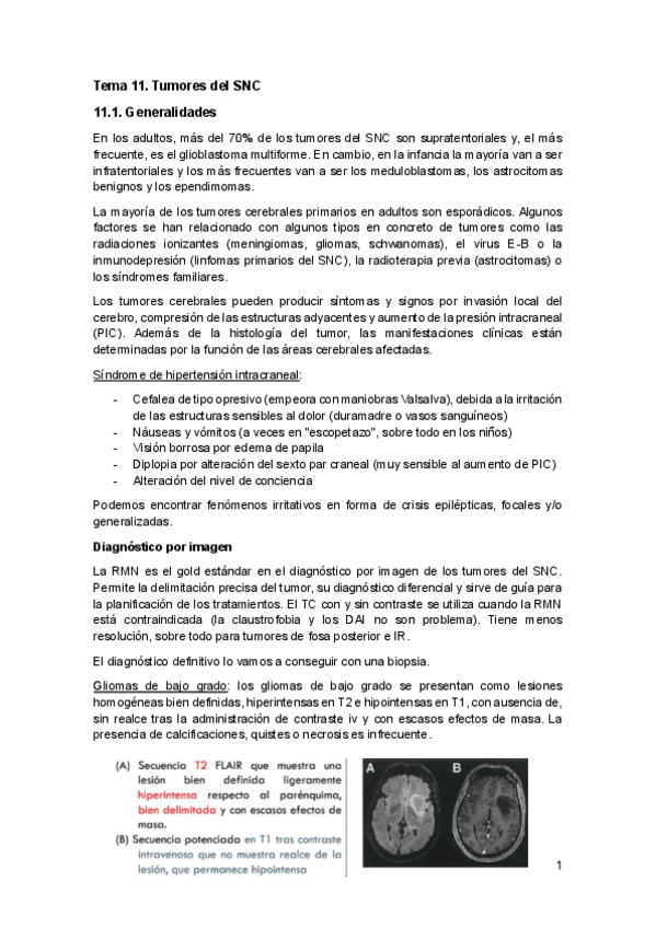 Miniatura del documento Tema-11.-Tumores-del-SNC.pdf