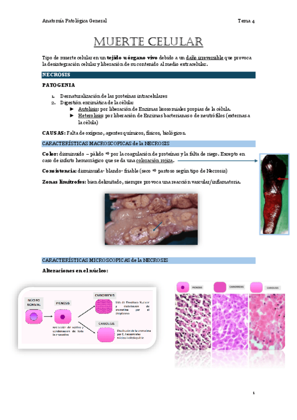 Miniatura del documento 4.-Muerte-celular.pdf