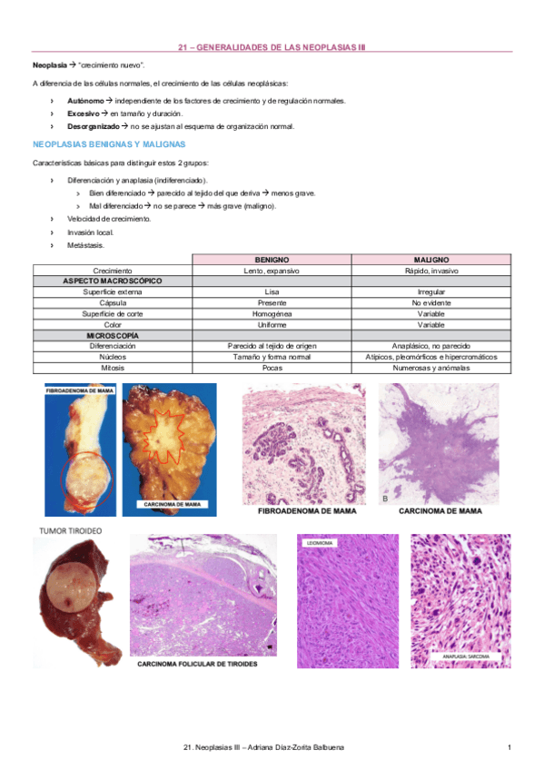 Miniatura del documento 21-Neoplasias-III.pdf