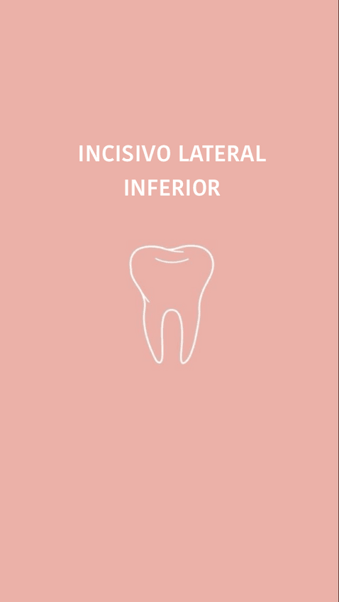 Miniatura del documento Incisivo-lateral-inferior.pdf