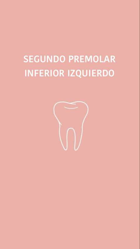 Miniatura del documento Segundo-premolar-inferior-izquierdo.pdf