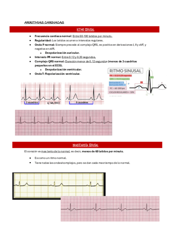 Miniatura del documento Arritmias.pdf