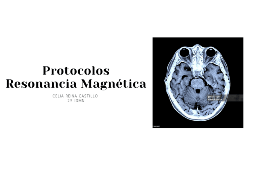 Miniatura del documento Protocolos-de-RM.pdf