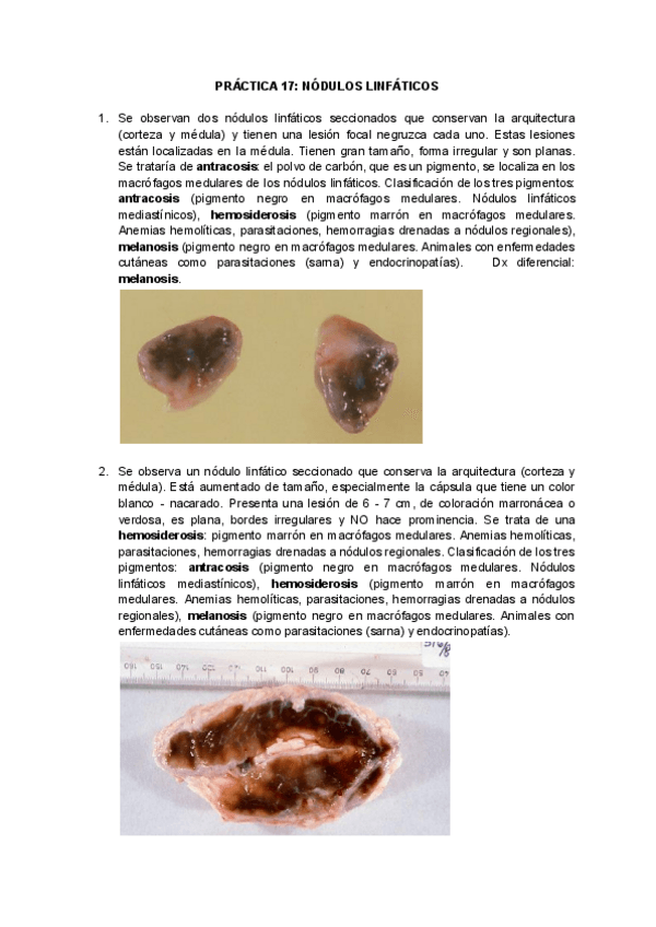Miniatura del documento PRACTICA-17-nodulos-linfaticos.pdf