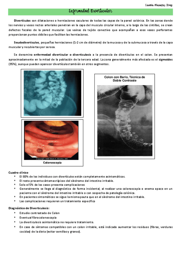 Miniatura del documento Dig.-8-Diverticulitis-constipacion-colon-irritable.pdf
