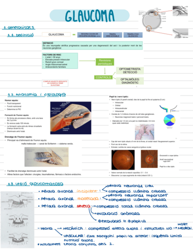 Miniatura del documento T5-Glaucoma.pdf