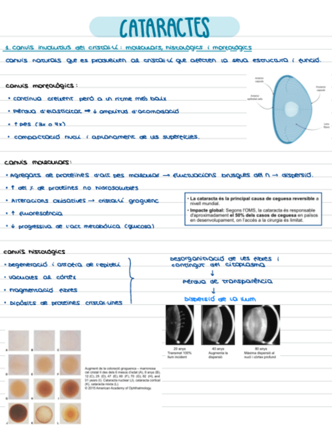 Miniatura del documento T3-Cataractes.pdf
