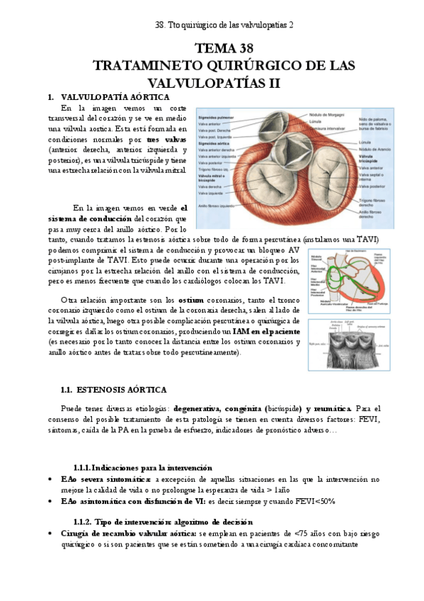 Miniatura del documento 38.-TTO-QX-DE-LAS-VALVULOPATIAS-2.pdf