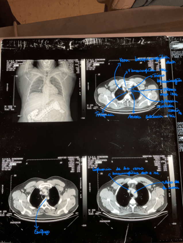 Miniatura del documento Imagenes-senaladas-ATI.pdf