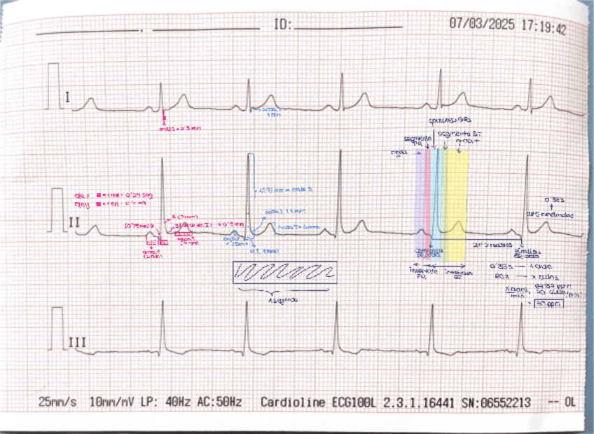 Miniatura del documento ECG-interpretacion.pdf