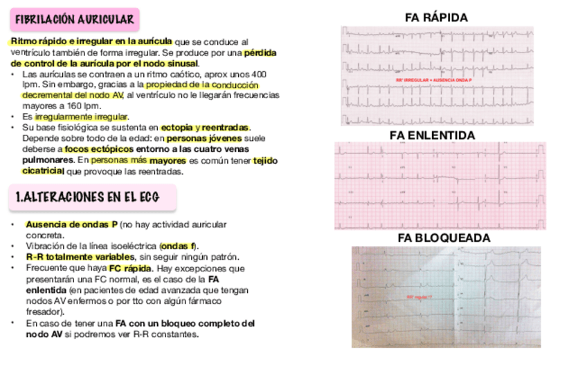 Miniatura del documento ACxFA-y-FLUTTER.pdf