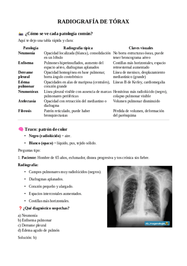 Miniatura del documento RADIOGRAFIA-DE-TORAX.pdf