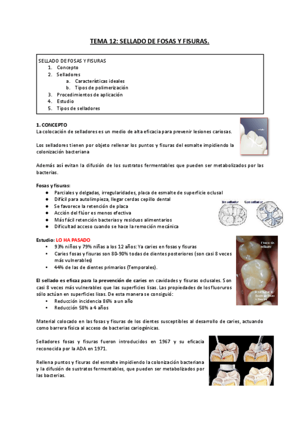 Miniatura del documento TEMA-12-SELLADO-DE-FOSAS-Y-FISURAS..docx.pdf