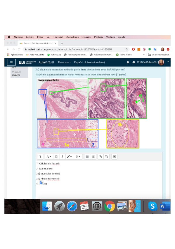 Miniatura del documento 2020-HISTOLOIGICO.pdf