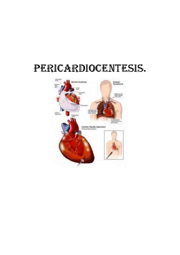 Miniatura del documento Pericardiocentesis.pdf