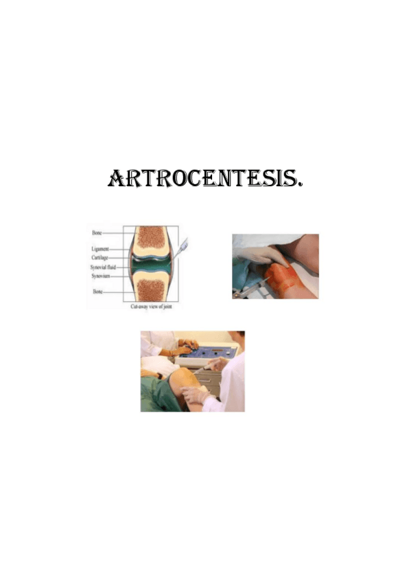 Miniatura del documento Artrocentesis.pdf