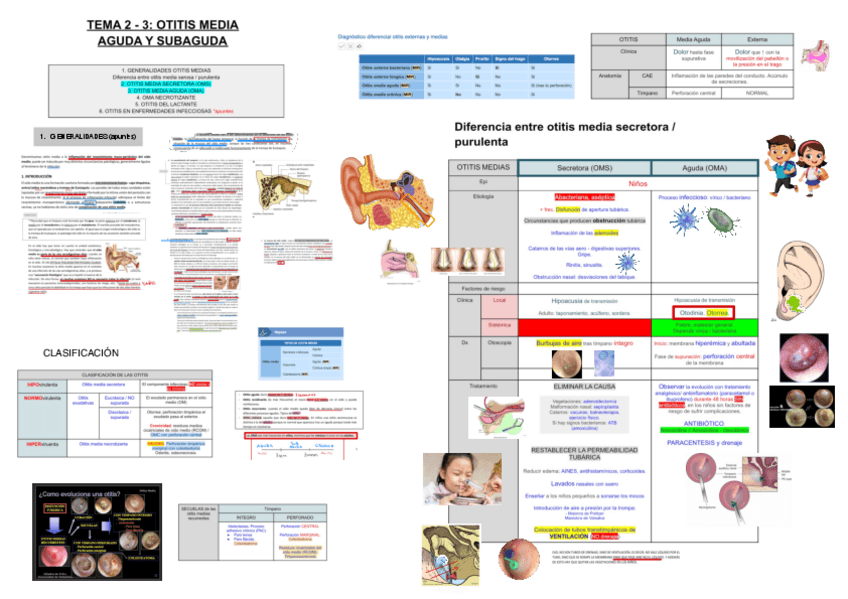 Miniatura del documento 2-3-OTITIS-MEDIA-AGUDA-Y-SUBAGUDA.pdf