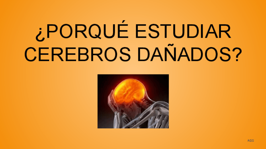 Miniatura del documento TEMA-1-NEURO CASTELLANO.pdf