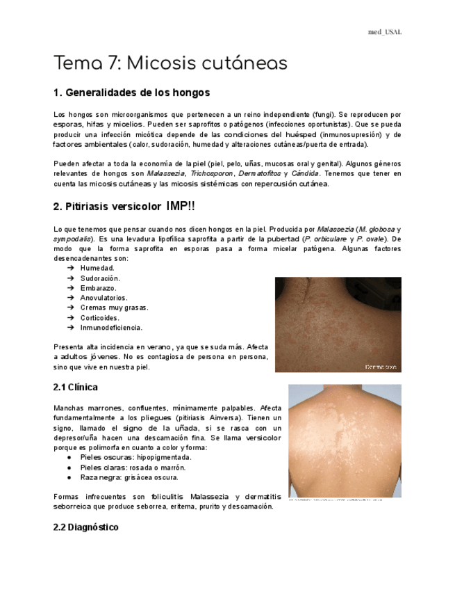 Miniatura del documento Tema-7-Micosis-cutaneas.pdf
