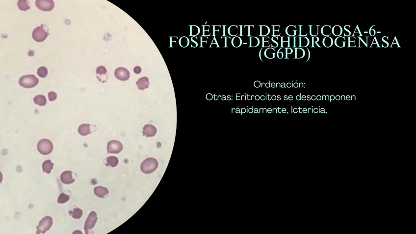 Miniatura del documento Estudio-de-las-anemias-1.mp4