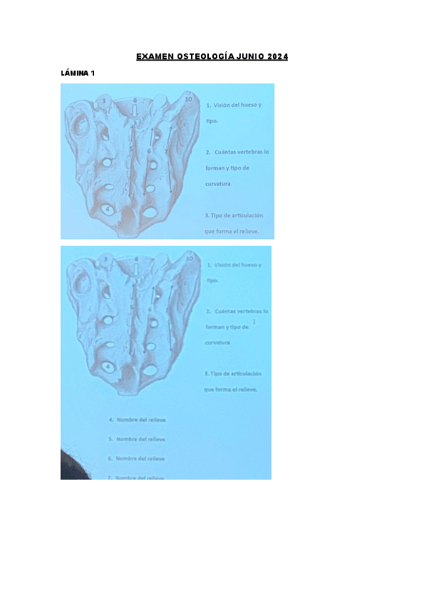 Miniatura del documento EXAMEN-OSTEOLOGIA-JUNIO-2024.pdf