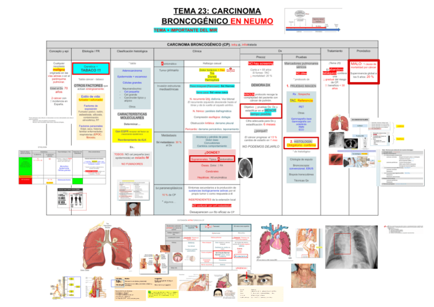 Miniatura del documento 23-CARCINOMA-BRONCOGENICO.pdf