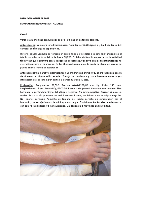 Miniatura del documento Seminario-sindromes-articularesCASO-12025-alumnos.pdf