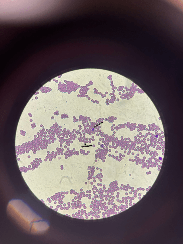 Miniatura del documento Seminario-4-Frotis-Sanguineo.pdf