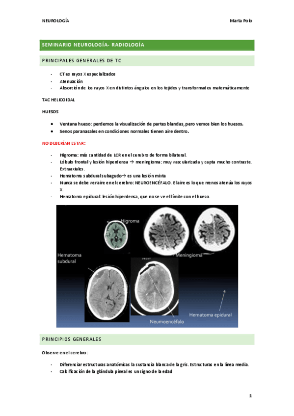 Miniatura del documento SEMINARIOS-NEURO.pdf