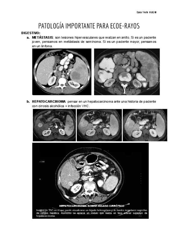Miniatura del documento PATOLOGIA-A-SABERSE-DE-RAYOS-PARA-EL-ECOE.pdf