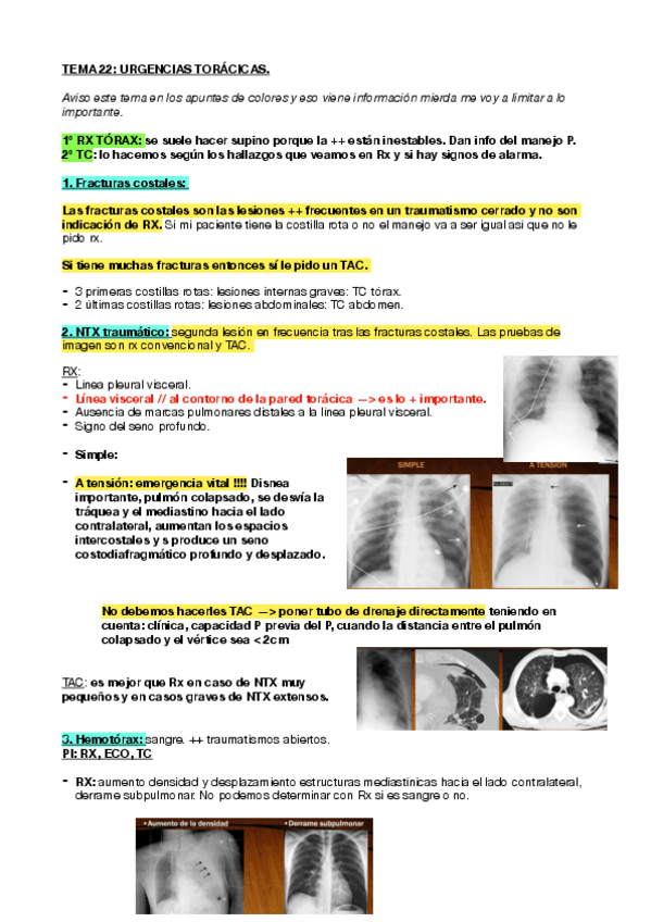 Miniatura del documento TEMA-22. URGENCIAS TORACICAS.pdf