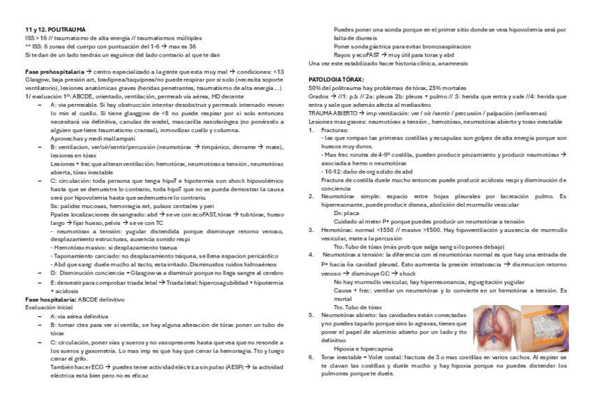 Miniatura del documento 11-y-12.-POLITRAUMA.pdf