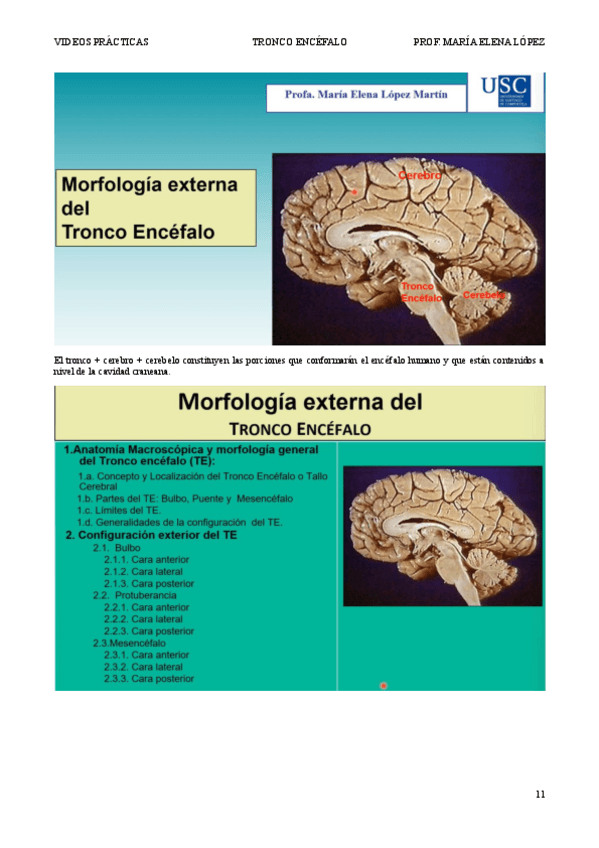 Miniatura del documento Practica-Tronco-Encefalo-transcripcion-video.pdf