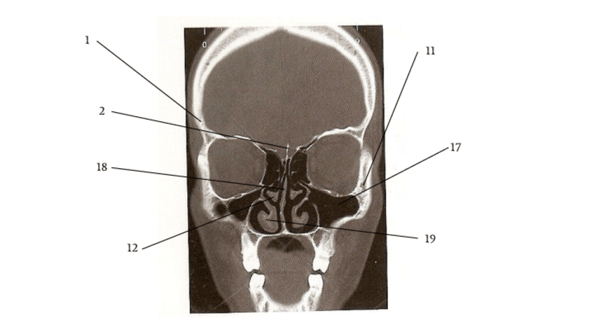 Miniatura del documento Imagenes-Cabeza-Sin-resolver.pdf