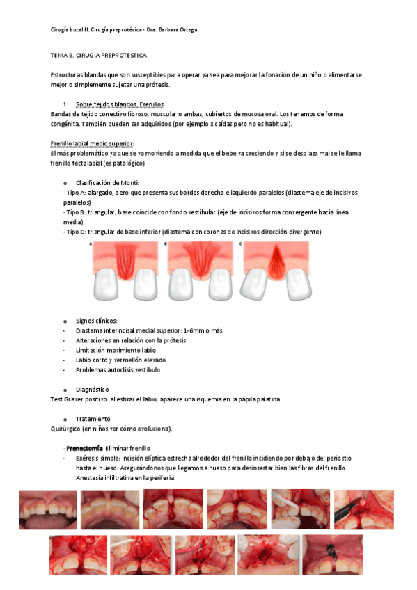 Miniatura del documento Tema-9.pdf