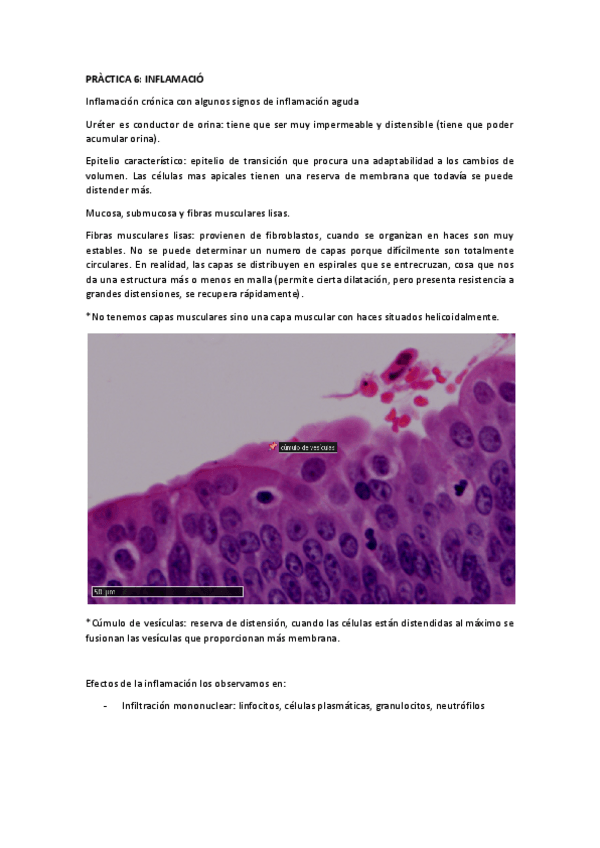 Miniatura del documento PRACTICA-6-Inflamacion.pdf