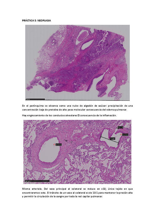 Miniatura del documento PRACTICA-5-Neoplasia.pdf