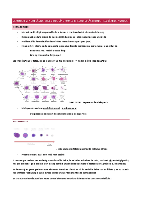 Miniatura del documento SEMINARI-2NEOPLASIES-MIELOIDES-SINDROMES-MIELODISPLASTIQUES-I-LEUCEMIES-AGUDES.pdf