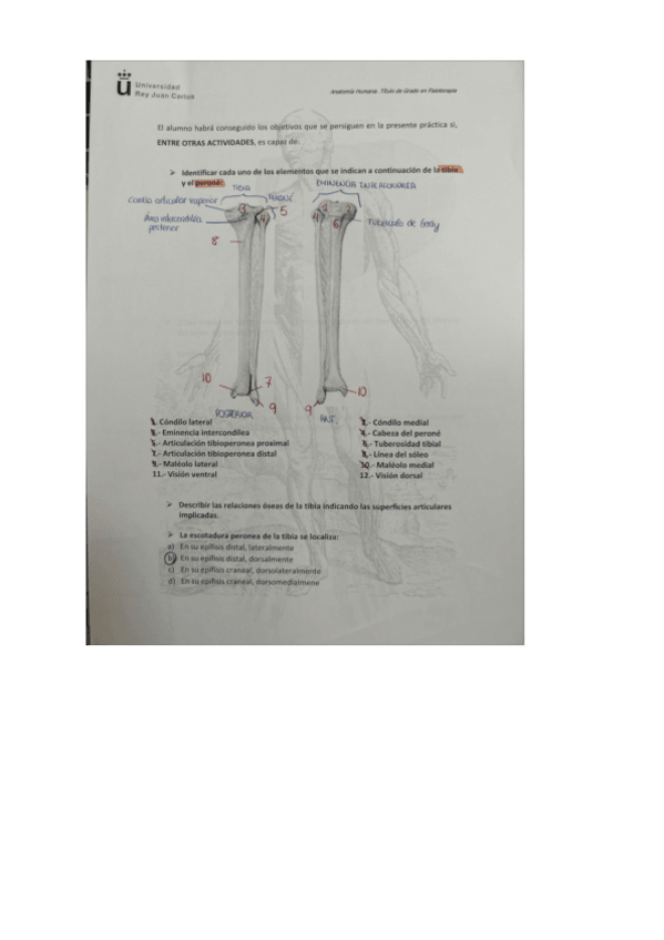 Miniatura del documento TIBIA-PERONE-Y-PIE-LAMINA.pdf