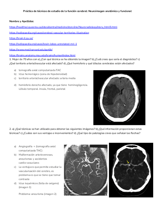 Miniatura del documento Neuroimagen-anatomica-2024.docx.pdf