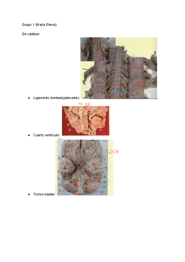 Miniatura del documento Practico-Neuro-listo.docx.pdf