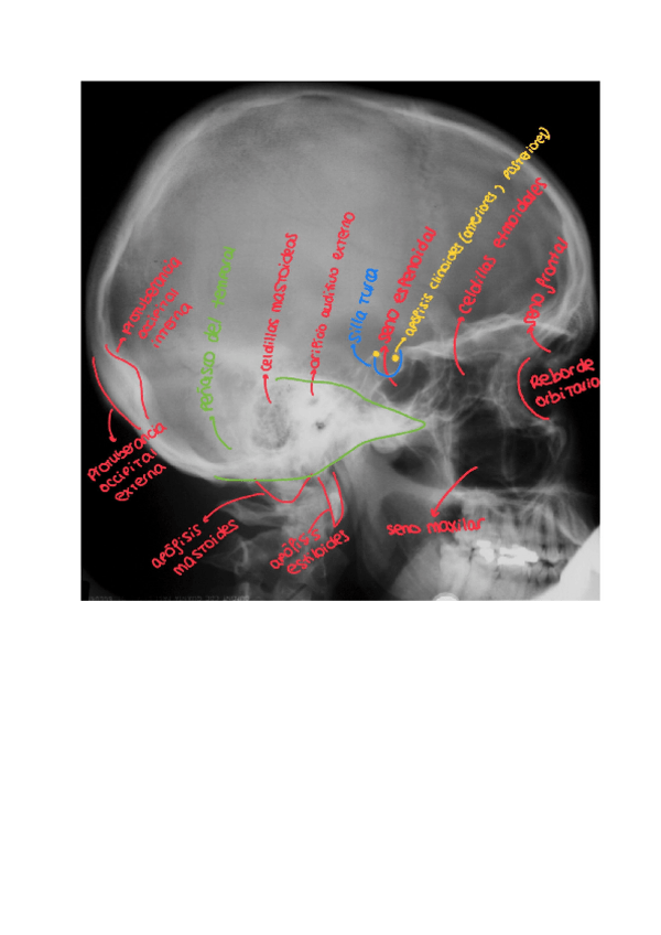 Miniatura del documento RAYOS-X-CRANEO.pdf