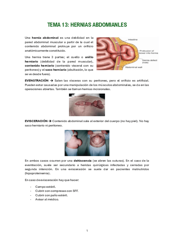Miniatura del documento HERNIAS-ABDOMIANLES.pdf