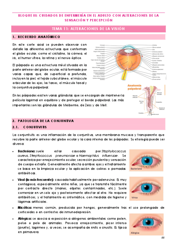 Miniatura del documento TEMA-11-ALTERACIONES-DE-LA-VISION.pdf