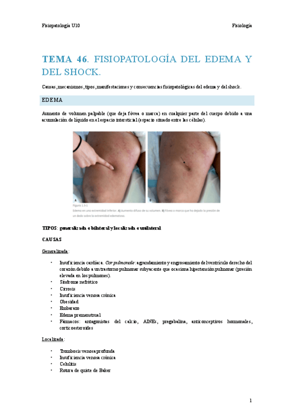 Miniatura del documento T46-Fisiopato.pdf
