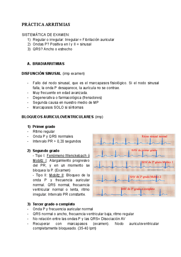 Miniatura del documento practica-arritmias.pdf