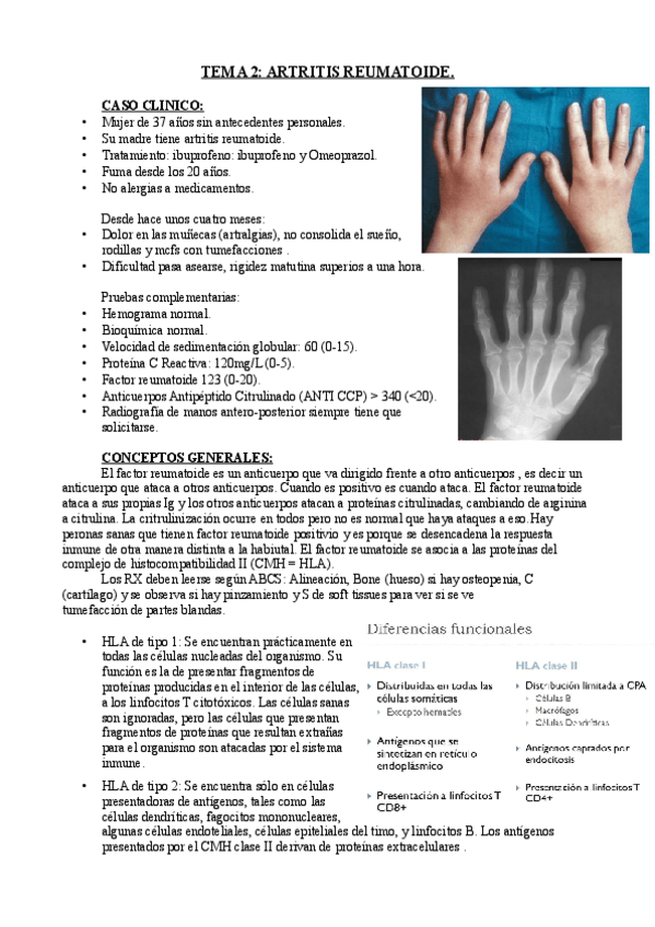Miniatura del documento TEMA 2. ARTRITIS REUMATOIDE..pdf
