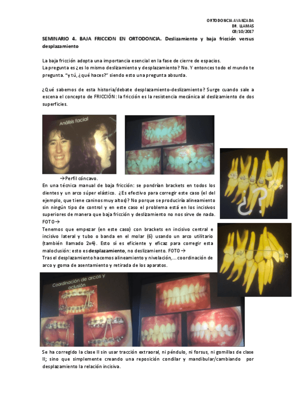 Miniatura del documento SEMINARIO 4.BAJA FRICCION EN ORTODONCIA.pdf